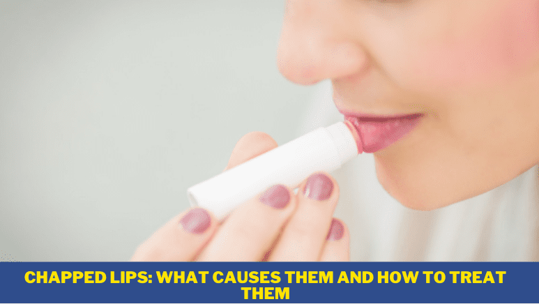 Chapped Lips: What Causes Them and How to Treat Them