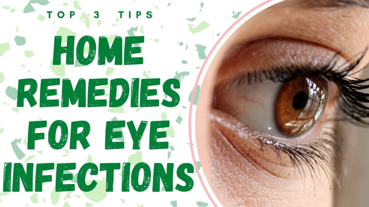 home remedy for eye problem
