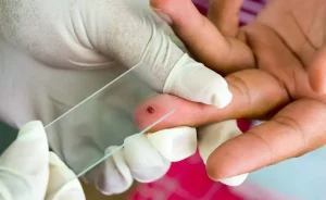 malaria test sample