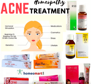 6 best homeopathic medicines for acne