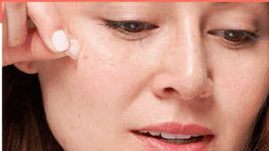 how do pimple patches work?