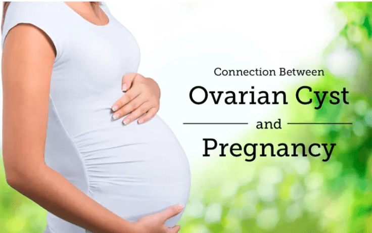 how ovarian cysts impact pregnancy
