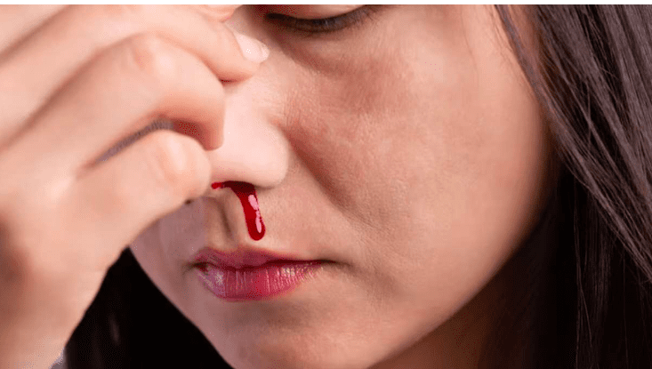 Lifestyle Factors That Can Contribute to Nose Bleeds