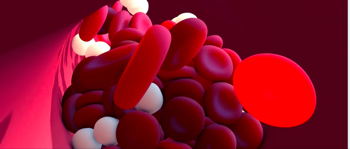 covid-19 blood clots