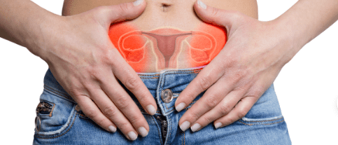 how ovarian cysts can cause infertility