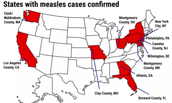 Measles Outbreak Map Shows 17 States