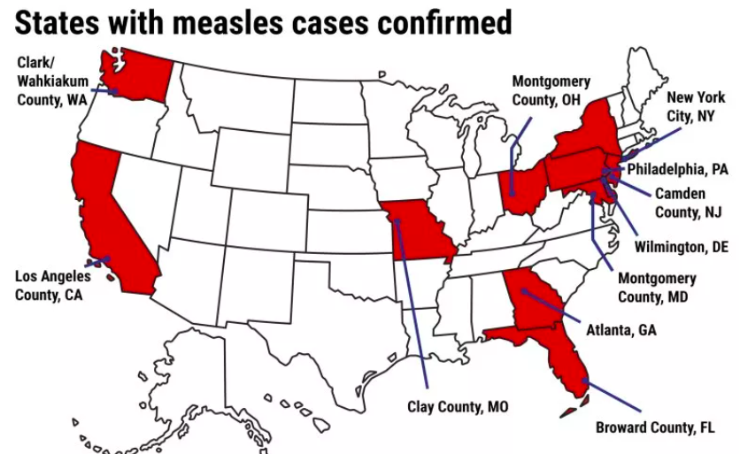 Measles Outbreak Map Shows 17 States