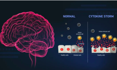 COVID Psychosis