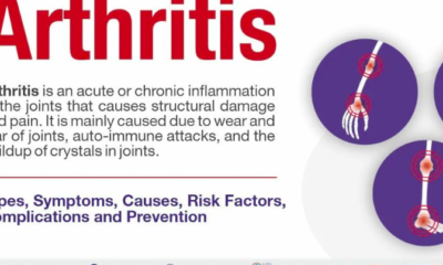 How Arthritis Affects the Body